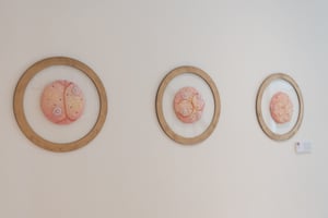 Three round framed artworks inspired by embryos on a wall at Care Fertility Tunbridge Wells