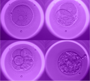 Caremaps Ai - award winning fertility care technology